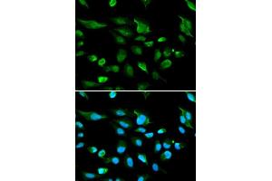 Immunofluorescence analysis of A549 cell using AIRE antibody. (AIRE anticorps  (AA 30-130))