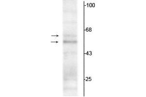Western blot of rat hippocampal lysate showing specific immunolabeling of the ~50 kDa TR-α1 and the ~58 kDa TR-α2 protein.