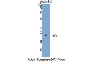 Western blot analysis of the recombinant protein. (RBP2 anticorps  (AA 1-134))