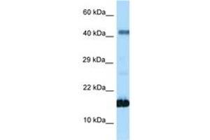 Image no. 1 for anti-Somatostatin (SST) (AA 35-84) antibody (ABIN6748033)