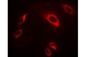 Immunofluorescent analysis of TRAF2 staining in Hela cells. (TRAF2 anticorps)