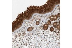 Immunohistochemical staining of human nasopharynx with KIAA0232 polyclonal antibody  shows strong cytoplasmic positivity in respiratory epithelial cells at 1:50-1:200 dilution.