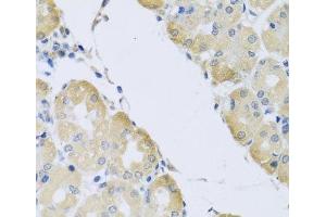 Immunohistochemistry of paraffin-embedded Human stomach using ATP2C1 Polyclonal Antibody at dilution of 1:100 (40x lens). (ATP2C1 anticorps)