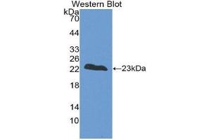 Western Blotting (WB) image for anti-Fast Skeletal Troponin I (TNNI2) (AA 1-182) antibody (ABIN1860816) (TNNI2 anticorps  (AA 1-182))