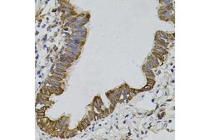 Immunohistochemistry of paraffin-embedded human lung using ARHGEF11 antibody. (ARHGEF11 anticorps)