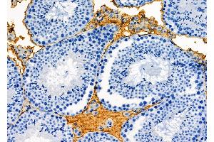 ABIN6261523 and ABIN6277133 at 1/100 staining Mouse testis tissue by IHC-P. (ELSPBP1 anticorps  (C-Term))