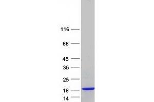 Validation with Western Blot