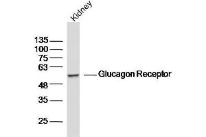 Mouse kidney lysates probed with Glucagon Receptor Polyclonal Antibody, unconjugated  at 1:300 overnight at 4°C followed by a conjugated secondary antibody for 60 minutes at 37°C. (Glucagon Receptor anticorps  (AA 11-110))
