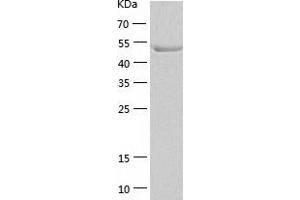 Western Blotting (WB) image for Glucokinase (Hexokinase 4) (GCK) (AA 1-465) protein (His-IF2DI Tag) (ABIN7123102)