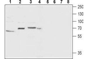Western blot analysis of rat ovary (lanes 1 and 5), rat brain (lanes 2 and 6), mouse brain membrane (lanes 3 and 7) and SH-SY5Y (lanes 4 and 8) lysate: - 1-4. (TACR1 anticorps  (2nd Extracellular Loop))