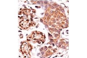 Image no. 2 for anti-ABL2 (ABL2) (Middle Region) antibody (ABIN358072) (ABL2 anticorps  (Middle Region))