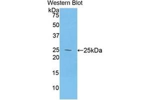 Detection of Recombinant DSC1, Human using Polyclonal Antibody to Desmocollin 1 (DSC1)