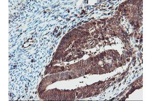 Image no. 11 for anti-serpin Peptidase Inhibitor, Clade B (Ovalbumin), Member 1 (SERPINB1) (AA 77-306) antibody (ABIN1491670)