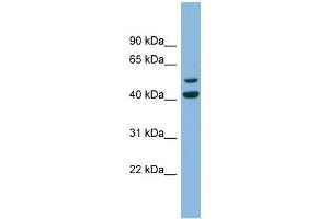 WB Suggested Anti-ANKMY2 Antibody Titration: 0. (ANKMY2 anticorps  (N-Term))