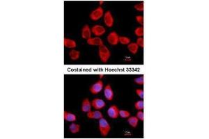 ICC/IF Image Immunofluorescence analysis of methanol-fixed A431, using RPLP2, antibody at 1:500 dilution.