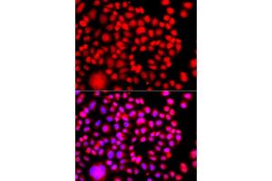 Immunofluorescence analysis of A549 cell using TESK2 antibody.