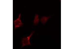 ABIN6274043 staining HepG2 by IF/ICC. (RhoA,B,C anticorps)