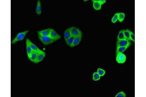 anti-Complement Component 5a Receptor 1 (C5AR1) (AA 1-36) antibody