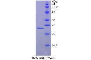 SDS-PAGE (SDS) image for CD47 (CD47) (AA 18-219) protein (His tag) (ABIN1879085) (CD47 Protein (CD47) (AA 18-219) (His tag))