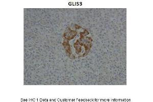 Sample Type :  Human Pancreas  Primary Antibody Dilution :  1:10  Secondary Antibody :  Anti-rabbit HRP  Secondary Antibody Dilution :  1:1000  Gene Name :  GLIS3  Submitted by :  Anonymous