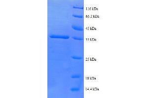 Chemokine (C-X-C Motif) Ligand 5 (CXCL5) (AA 37-110), (partial) protein (GST tag)
