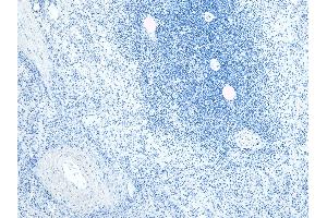 (ABIN185249) Negative Control showing staining of paraffin embedded Human Spleen, with no primary antibody.