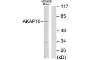 Western blot analysis of extracts from mouse brain cells, using AKAP10 Antibody.