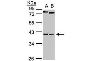 WB Image Sample(30 ug whole cell lysate) A:H1299 B:Raji , 10% SDS PAGE antibody diluted at 1:1000 (NK2 Homeobox 5 anticorps)
