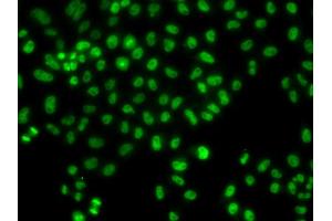 Immunofluorescence analysis of HeLa cells using LHX8 antibody (ABIN6293049). (LHX8 anticorps)