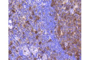 Paraformaldehyde-fixed, paraffin embedded human tonsil section, Antigen retrieval by boiling in sodium citrate buffer (pH6) for 15min, Block endogenous peroxidase by 3% hydrogen peroxide for 30 minutes, Blocking buffer (normal serum) at 37°C for 20min, Antibody incubation with Cdk6 (4F7) Monoclonal Antibody  at 1:50 overnight at 4°C, followed by a conjugated secondary and DAB staining.