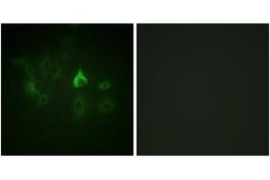 Immunofluorescence (IF) image for anti-BMX Non-Receptor Tyrosine Kinase (BMX) (AA 532-581) antibody (ABIN2888766) (BMX anticorps  (AA 532-581))
