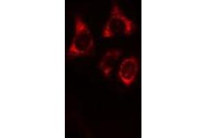 ABIN6269358 staining HeLa cells by IF/ICC. (IRF3 anticorps  (C-Term))