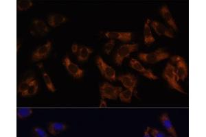 Immunofluorescence analysis of U-2 OS cells using RPL36AL Polyclonal Antibody at dilution of 1:100 (40x lens).