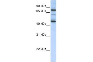 WB Suggested Anti-GAS2L1 Antibody Titration: 0. (GAS2L1 anticorps  (Middle Region))