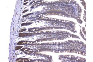 IHC analysis of PPID using anti-PPID antibody (ABIN6719438). (PPID anticorps  (AA 306-370))