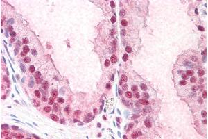 ABIN184855 (5µg/ml) staining of paraffin embedded Human Prostate.
