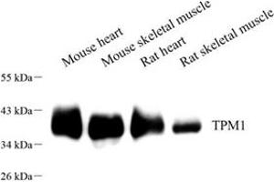 Western blot analysis of TPM1 (ABIN7076030),at dilution of 1: 400 (Tropomyosin anticorps)