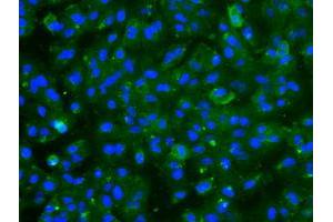 Image no. 5 for anti-Cardiac Troponin I (TNNI3) antibody (ABIN1497101)
