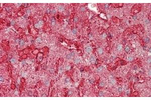 Detection of ANXA4 in Human Liver Tissue using Polyclonal Antibody to Annexin A4 (ANXA4)