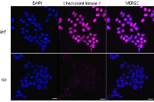 Immunocytochemical staining of Hela cells using Checkpoint kinase 2 antibody (ABIN7798039), 1:1,000), Top panel: wild-type (WT), Bottom panal: Checkpoint kinase 2 shRNA knockdown (KD).