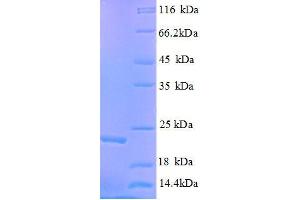 SDS-PAGE (SDS) image for GTPase Kras (KRAS) (AA 2-168) protein (His tag) (ABIN1047141)