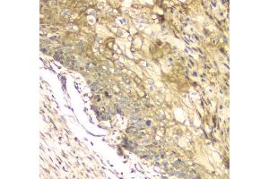 IHC analysis of MCUR1 using anti-MCUR1 antibody (ABIN6719261).