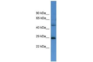 WB Suggested Anti-SPR  Antibody Titration: 0. (SPR anticorps  (C-Term))