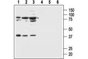 Western blot analysis of human normal skin fibroblast cell line Malme-3 (lanes 1 and 4) and human malignant melanoma cell lines Malme-3M (lanes 2 and 5) and A875 (lanes 3 and 6): - 1,2,3.