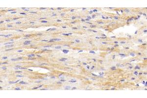 Detection of BACE2 in Mouse Cardiac Muscle Tissue using Polyclonal Antibody to Beta Secretase 2 (BACE2)