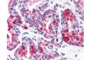 Immunohistochemistry (IHC) image for anti-Wingless-Type MMTV Integration Site Family, Member 5B (WNT5B) (Internal Region) antibody (ABIN2469506)