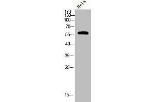 Western Blot analysis of Hela cells using Phospho-PFK-2 car (S483) Polyclonal Antibody