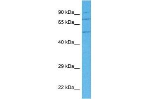 Host:  Rabbit  Target Name:  ANXA7  Sample Tissue:  Human 786-0 Whole Cell  Antibody Dilution:  1ug/ml (Annexin VII anticorps  (N-Term))