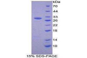 SDS-PAGE (SDS) image for Kallikrein 5 (KLK5) (AA 25-261) protein (His tag) (ABIN1878896) (Kallikrein 5 Protein (KLK5) (AA 25-261) (His tag))