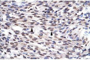 Human Heart; Rabbit Anti-GFI1B Antibody. (GFI1B anticorps  (N-Term))